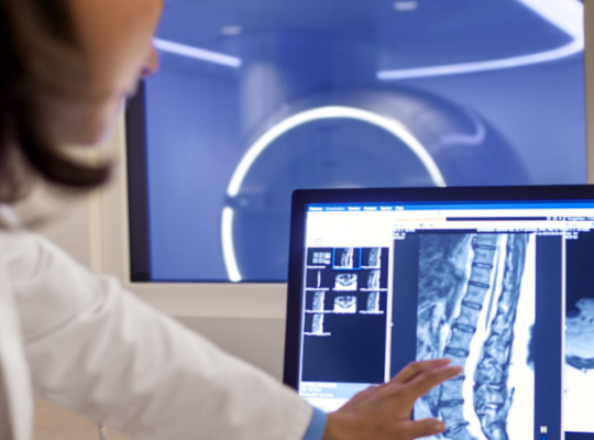 Aparat MRI